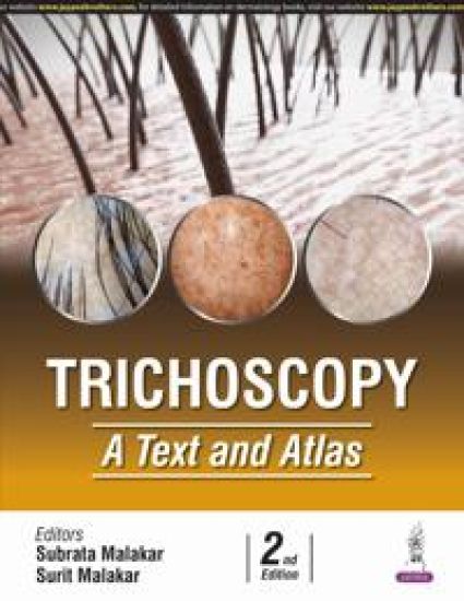 Trichoscopy