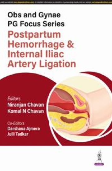Obs and Gynae PG Focus Series: Postpartum Hemorrhage and Internal Iliac Artery Ligation – Niranjan Chavan, kirjan kansikuva