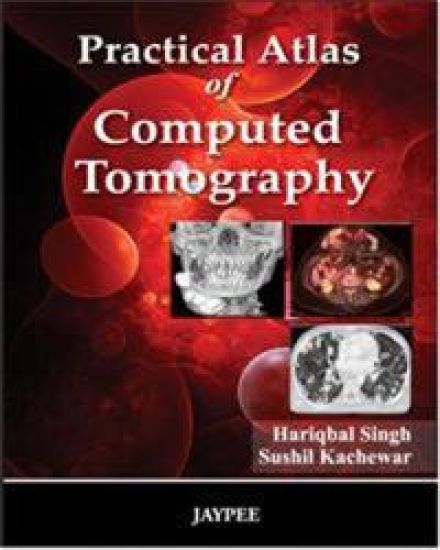 Practical Atlas of Computed Tomography