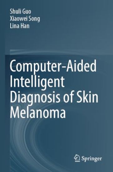 Computer-Aided Intelligent Diagnosis of Skin Melanoma