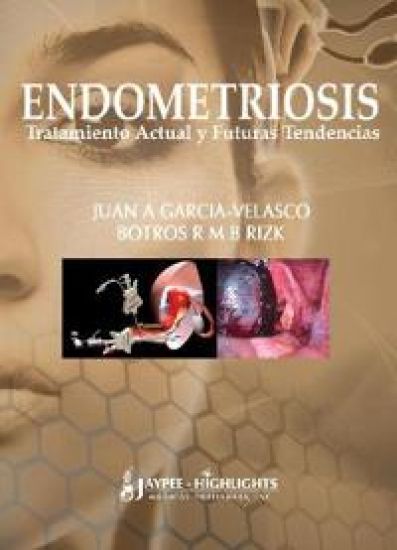 Endometriosis: Tratamiento Actual y Futuras Tendencias