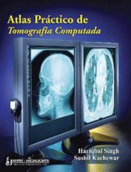 Atlas Práctico de Tomografia Computada