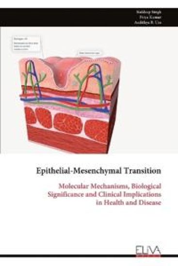 Epithelial-Mesenchymal Transition