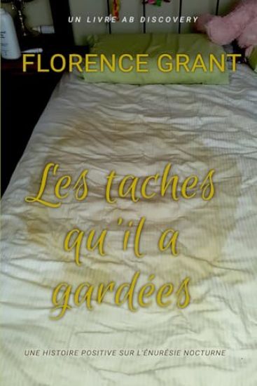 Les taches qu'il a gardées